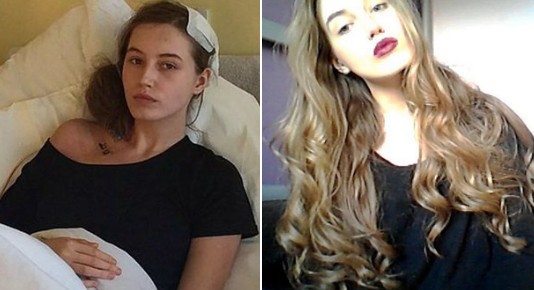 Waking Up During Brain Surgery, She Starts Talking… About Cats